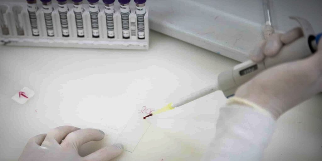 secretaria-de-saude-de-sp-investiga-novo-caso-suspeito-de-ebola