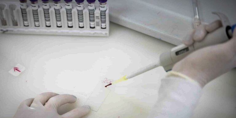 secretaria-de-saude-de-sp-investiga-novo-caso-suspeito-de-ebola