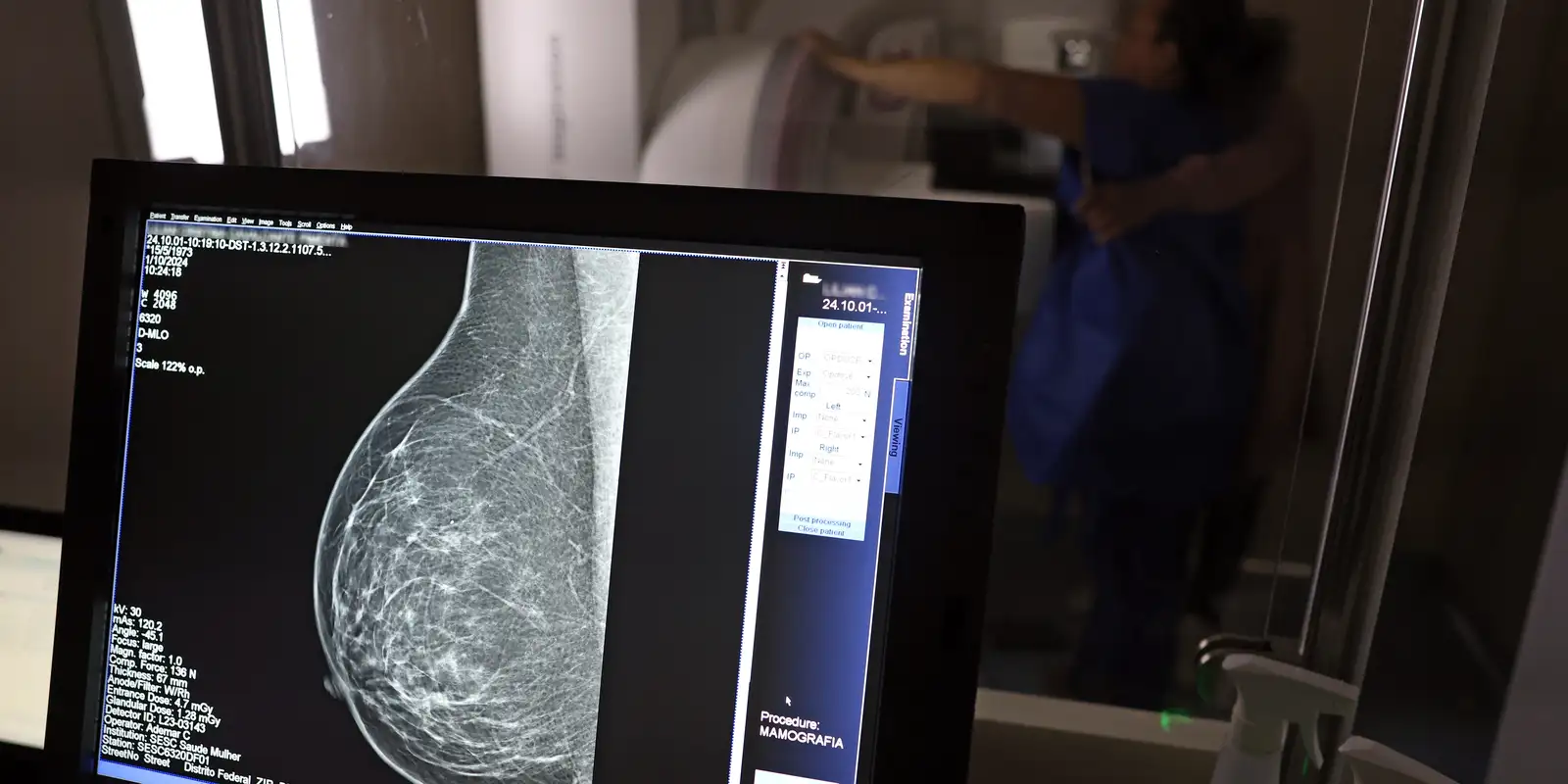 medicos-lancam-guia-para-evitar-recusa-de-mamografia-digital